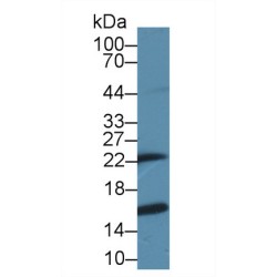 Glutathione S-Transferase P (GSTP1) Antibody
