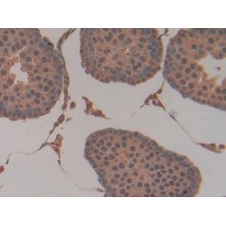 Glutathione S-Transferase P (GSTP1) Antibody