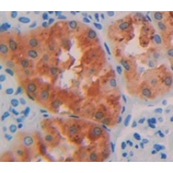 Homogentisate-1,2-Dioxygenase (HGD) Antibody