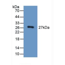 Homogentisate-1,2-Dioxygenase (HGD) Antibody