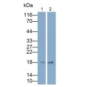 WB analysis of Mouse cerebrum lysate (lane 1) and Rat liver lysate (lane 2), using IGF1 antibody (0.15 µg/ml) and HRP-conjugated Goat Anti-Rabbit antibody (<a href="https://www.abbexa.com/index.php?route=product/search&amp;search=abx400043" target="_blank">abx400043</a>, 0.2 µg/ml).