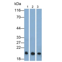 Insulin-Like Growth Factor 1 (IGF1) Antibody