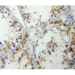 Insulin Like Growth Factor 2 (IGF2) Antibody