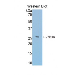 Interleukin 2 Receptor Beta (IL2RB) Antibody