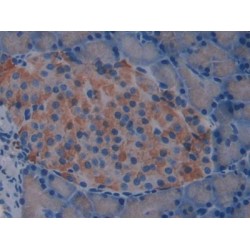 Interleukin 2 Receptor Beta (IL2RB) Antibody