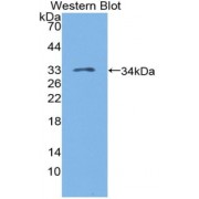 Western blot analysis of recombinant Human LAG3.