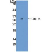 abx102895