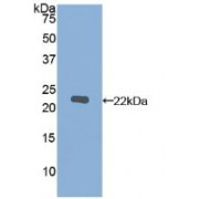 Western blot analysis of recombinant Human MMP12.