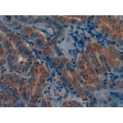 Matrix Metalloproteinase 12 (MMP12) Antibody