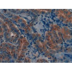 Matrix Metalloproteinase 12 (MMP12) Antibody