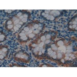 Matrix Metalloproteinase 12 (MMP12) Antibody