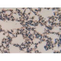 Macrophage Metalloelastase (MMP12) Antibody