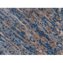 Macrophage Metalloelastase (MMP12) Antibody