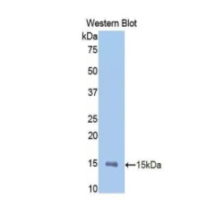 Macrophage Metalloelastase (MMP12) Antibody