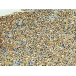 Collagenase 3 (MMP13) Antibody