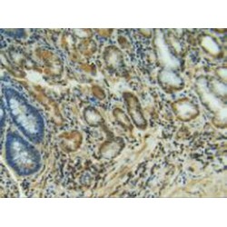 Collagenase 3 (MMP13) Antibody