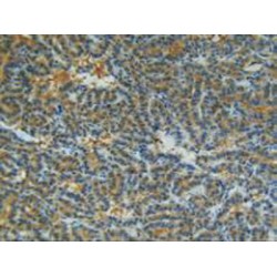 Collagenase 3 (MMP13) Antibody