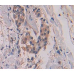 Collagenase 3 (MMP13) Antibody