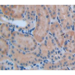 Collagenase 3 (MMP13) Antibody