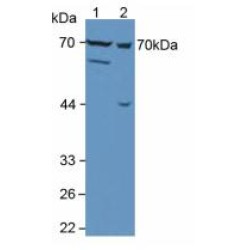 Collagenase 3 (MMP13) Antibody