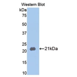 Collagenase 3 (MMP13) Antibody