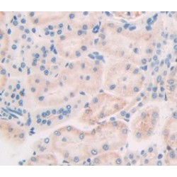 Collagenase 3 (MMP13) Antibody