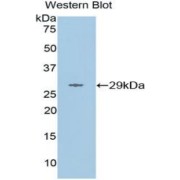 Western blot analysis of the recombinant protein.