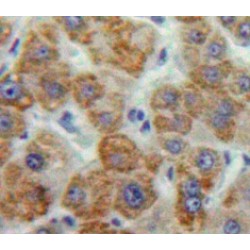 Matrix Metalloproteinase 16 (MMP16) Antibody