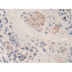 Matrix Metalloproteinase 24 (MMP24) Antibody