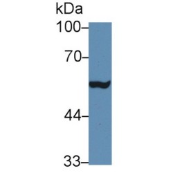 Matrix Metalloproteinase 24 (MMP24) Antibody