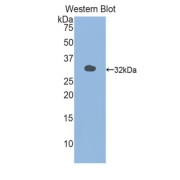 abx102917