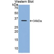Western blot analysis of the recombinant protein.
