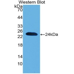 Parkinson Disease Protein 7 (PARK7) Antibody