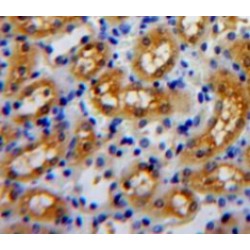 Parkinson Disease Protein 7 (PARK7) Antibody