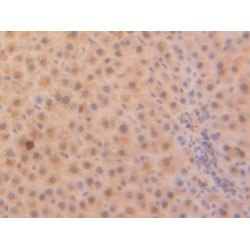 Parkinson Disease Protein 7 (PARK7) Antibody
