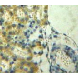 Parkinson Disease Protein 7 (PARK7) Antibody
