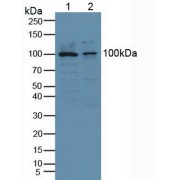 Western blot analysis of (1) Human HeLa cells and (2) Human PC-3 Cells.