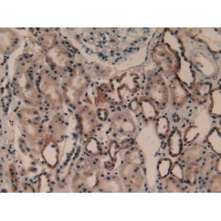 Cytosolic Phospholipase A2 (PLA2G4A) Antibody