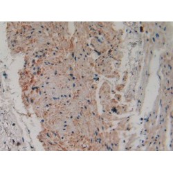 Cytosolic Phospholipase A2 (PLA2G4A) Antibody