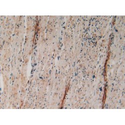 Cytosolic Phospholipase A2 (PLA2G4A) Antibody