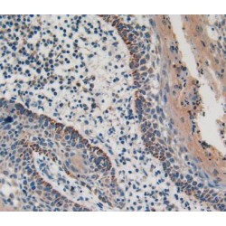 Cytosolic Phospholipase A2 (PLA2G4A) Antibody