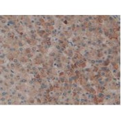 Plasminogen Activator, Tissue (tPA) Antibody