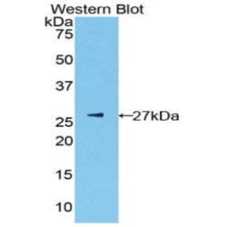 Pyruvate Kinase PKLR (PKLR) Antibody