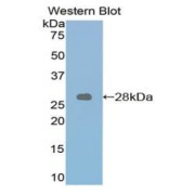 abx102933