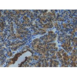 S100A1 Calcium Binding Protein (S100A1) Antibody