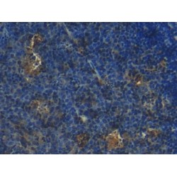 S100A1 Calcium Binding Protein (S100A1) Antibody