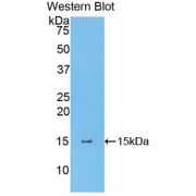 Western blot analysis of the recombinant protein.