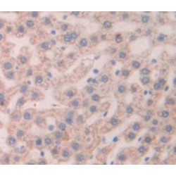 Thymic Stromal Lymphopoietin (TSLP) Antibody