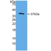 Western blot analysis of recombinant Mouse TFF3.
