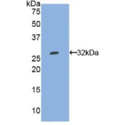 Tryptophanyl tRNA Synthetase (WARS) Antibody